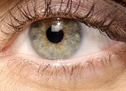 dry eyes